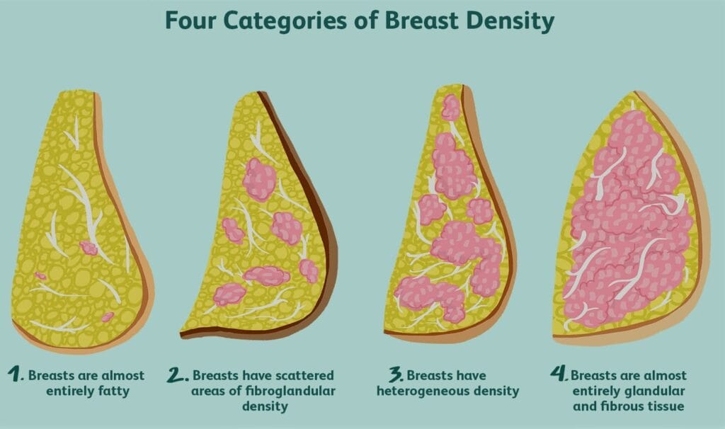 Risk Factors Of Breast Cancer Causes Types Of Breast Cancer